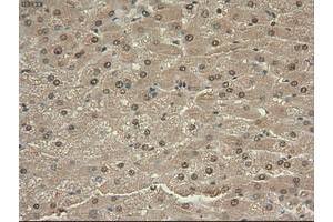 Image no. 13 for anti-Myc Proto-Oncogene protein (MYC) antibody (ABIN1497011) (c-MYC 抗体)