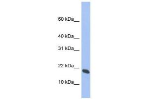 GMF gamma antibody used at 1 ug/ml to detect target protein. (GMFG 抗体  (Middle Region))