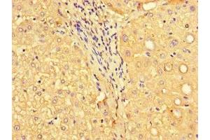 Immunohistochemistry of paraffin-embedded human liver tissue using ABIN7160576 at dilution of 1:100 (MYH3 抗体  (AA 1-217))