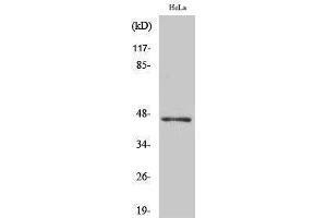 Western Blotting (WB) image for anti-Acyl-CoA Thioesterase 4 (ACOT4) (C-Term) antibody (ABIN3183149) (ACOT4 抗体  (C-Term))