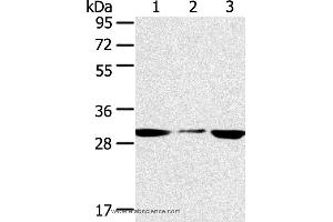 Western blot analysis of PC3 and hepg2 cell, human fetal liver tissue, using SDHB Polyclonal Antibody at dilution of 1:400 (SDHB 抗体)