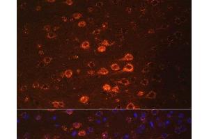 Immunofluorescence analysis of Mouse brain using NEFM Polyclonal Antibody at dilution of 1:100. (NEFM 抗体)