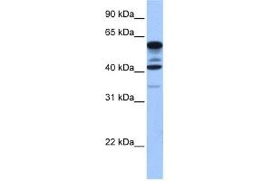WB Suggested Anti-FAM46C Antibody Titration: 0. (FAM46C 抗体  (Middle Region))
