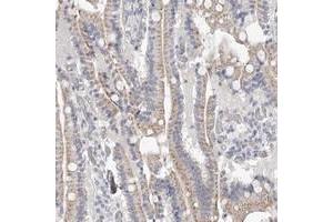 Immunohistochemical staining of human duodenum with NT5DC1 polyclonal antibody  shows moderate cytoplasmic positivity in glandular cells. (NT5DC1 抗体)
