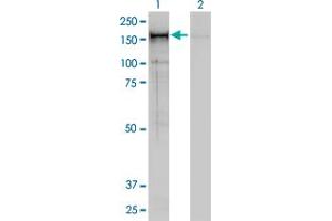 Western Blotting (WB) image for anti-Non-SMC Condensin I Complex, Subunit D2 (NCAPD2) (AA 1240-1339) antibody (ABIN599100) (NCAPD2 抗体  (AA 1240-1339))