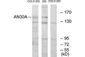 Western blot analysis of extracts from 293/COLO cells, using AN30A Antibody. (ANKRD30A 抗体  (AA 1041-1090))