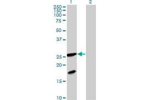 Western Blot analysis of FXN expression in transfected 293T cell line by FXN MaxPab polyclonal antibody. (Frataxin 抗体  (AA 1-210))