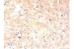 IHC-P analysis of Human Prostate Gland Tissue, with DAB staining. (IL-13 抗体  (AA 25-146))