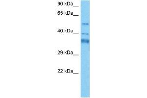 Western Blotting (WB) image for anti-General Transcription Factor IIH, Polypeptide 4, 52kDa (GTF2H4) (N-Term) antibody (ABIN2777490)
