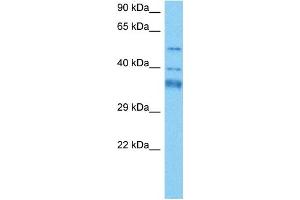 Host:  Mouse  Target Name:  GTF2H4  Sample Tissue:  Mouse Heart  Antibody Dilution:  1ug/ml (GTF2H4 抗体  (N-Term))