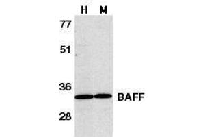 Western blot analysis of BAFF in human HL60 cell lysate (H) and murine spleen tissue lysate (M) with BAFF antibody at 1μg/ml. (BAFF 抗体  (C-Term))