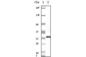 Western Blotting (WB) image for anti-S100 Calcium Binding Protein A6 (S100A6) (truncated) antibody (ABIN2464024) (S100A6 抗体  (truncated))