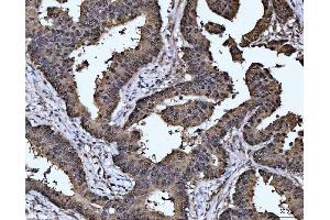IHC analysis of MAT2A using anti-MAT2A antibody (ABIN7599120).