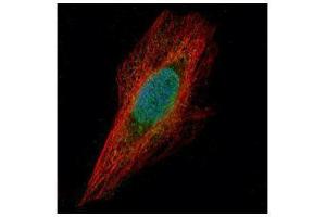 ICC/IF Image Confocal immunofluorescence analysis (Olympus FV10i) of paraformaldehyde-fixed HeLa, using Chk1, antibody (Green) at 1:500 dilution. (CHEK1 抗体  (C-Term))