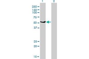 Western Blotting (WB) image for anti-GA Binding Protein Transcription Factor, alpha Subunit 60kDa (GABPA) (AA 1-454) antibody (ABIN560978)