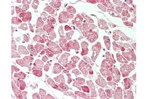 Human Heart: Formalin-Fixed, Paraffin-Embedded (FFPE).