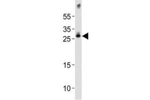 Western blot analysis of lysate from mouse brain tissue lysate using Olig1 antibody diluted at 1:1000. (OLIG1 抗体  (AA 161-194))