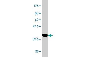 Western Blot detection against Immunogen (37. (Retinoic Acid Receptor alpha 抗体  (AA 315-424))