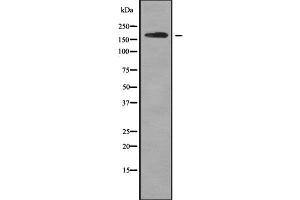 Western blot analysis of ROBO1 using MCF7 whole cell lysates (ROBO1 抗体  (Internal Region))