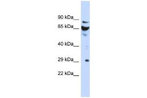 DCUN1D3 antibody used at 1 ug/ml to detect target protein. (DCUN1D3 抗体)