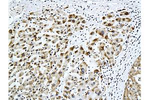 Immunohistochemistry (IHC) image for anti-Hepatitis B Virus Surface Antigen (HBsAg) antibody (ABIN723066)