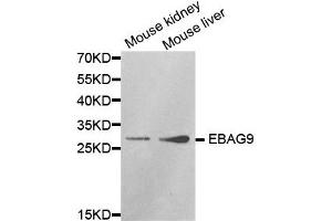 Western Blotting (WB) image for anti-Estrogen Receptor Binding Site Associated, Antigen, 9 (EBAG9) antibody (ABIN1872406) (RCAS1 抗体)