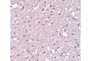 Immunohistochemistry (IHC) image for anti-Transmembrane Protein 184A (TMEM184A) (C-Term) antibody (ABIN1030750) (TMEM184A 抗体  (C-Term))