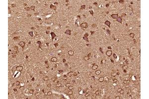 Paraformaldehyde-fixed, paraffin embedded mouse brain tissue, Antigen retrieval by boiling in sodium citrate buffer (pH6. (CAMK2B 抗体  (AA 1-100))