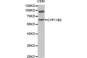 Western Blotting (WB) image for anti-Cytochrome P450, Family 11, Subfamily B, Polypeptide 2 (CYP11B2) (AA 234-503) antibody (ABIN1679468) (CYP11B2 抗体  (AA 234-503))