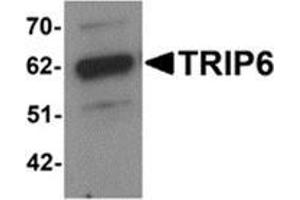 Western blot analysis of TRIP6 in EL4 cell lysate with TRIP6 antibody at 1 μg/ml. (TRIP6 抗体  (Center))