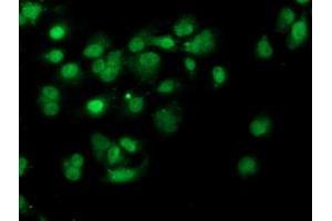 Anti-PDSS2 mouse monoclonal antibody (ABIN2455333) immunofluorescent staining of COS7 cells transiently transfected by pCMV6-ENTRY PDSS2 (RC207892). (PDSS2 抗体)