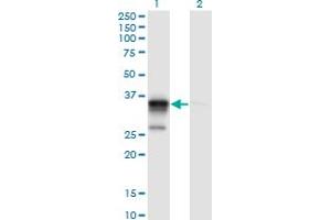 Western Blot analysis of ACOT8 expression in transfected 293T cell line by ACOT8 monoclonal antibody (M03), clone 3F1. (ACOT8 抗体  (AA 108-215))