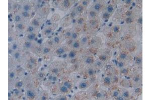 Detection of HO1 in Human Liver Tissue using Polyclonal Antibody to Heme Oxygenase 1 (HO1) (HMOX1 抗体  (AA 61-172))