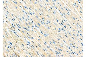 ABIN6258536 and ABIN6274873 at 1/100 staining Rat heart tissue by IHC-P.