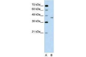 LRP2BP antibody used at 1 ug/ml to detect target protein. (LRP2BP 抗体  (Middle Region))
