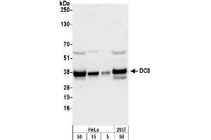 Western Blotting (WB) image for anti-NSL1, MIND Kinetochore Complex Component, Homolog (NSL1) (C-Term) antibody (ABIN7450152)