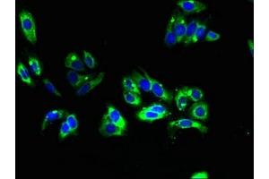 Immunofluorescent analysis of HepG2 cells using ABIN7173199 at dilution of 1:100 and Alexa Fluor 488-congugated AffiniPure Goat Anti-Rabbit IgG(H+L) (TMEM31 抗体  (AA 1-118))