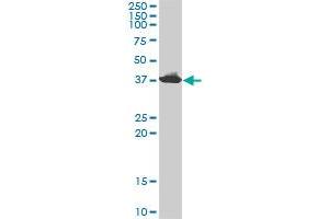 ADA monoclonal antibody (M01), clone 4G4-1C6. (ADA 抗体  (AA 1-363))