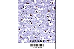 TARBP2 Antibody immunohistochemistry analysis in formalin fixed and paraffin embedded human brain tissue followed by peroxidase conjugation of the secondary antibody and DAB staining. (TARBP2 抗体  (N-Term))
