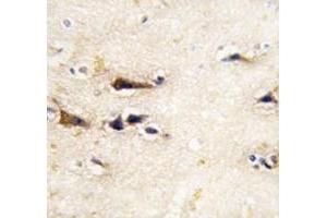 IHC analysis of FFPE human brain tissue stained with BACE1 antibody (BACE1 抗体  (AA 38-70))