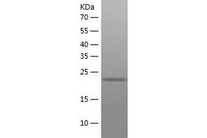 Western Blotting (WB) image for Malectin (MLEC) (AA 29-269) protein (His tag) (ABIN7123838) (Malectin Protein (MLEC) (AA 29-269) (His tag))