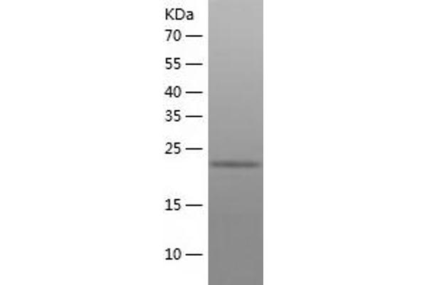 Malectin Protein (MLEC) (AA 29-269) (His tag)