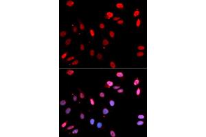 Immunofluorescence analysis of U2OS cells using Rad18 antibody (ABIN6128609, ABIN6146628, ABIN6146630 and ABIN6217430). (RAD18 抗体  (AA 216-495))