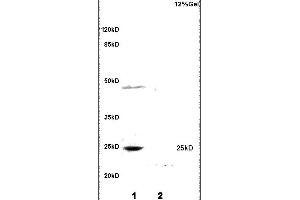 Formalin-fixed and paraffin embedded rat heart tissue labeled with Anti MYOG/MYOGENIN Polyclonal Antibody,Unconjugated (ABIN700660) at 1:200 followed by conjugation to the secondary antibody and DAB staining. (Myogenin 抗体)