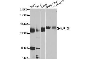 Western blot analysis of extracts of various cell lines, using NUP155 Antibody (ABIN5975637) at 1/1000 dilution. (NUP155 抗体)