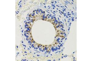 Immunohistochemistry of paraffin-embedded mouse lung using CALB2 antibody at dilution of 1:100 (x40 lens). (Calretinin 抗体)