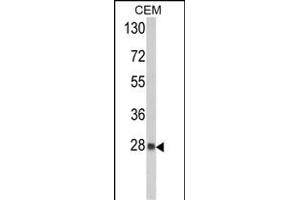 Western blot analysis of PRDX6 Antibody (C-term) (ABIN389471 and ABIN2839535) in CEM cell line lysates (35 μg/lane).