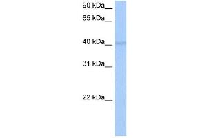RBM4 antibody used at 0. (RBM4 抗体  (C-Term))