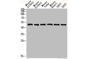 Western blot analysis of mouse-kidney lysate, antibody was diluted at 2000. (FCGR1A 抗体  (AA 230-280))