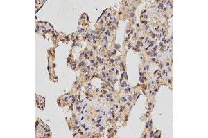 Immunohistochemistry (IHC) image for anti-Neuropilin 2 (NRP2) (AA 150-420) antibody (ABIN6219689) (NRP2 抗体  (AA 150-420))